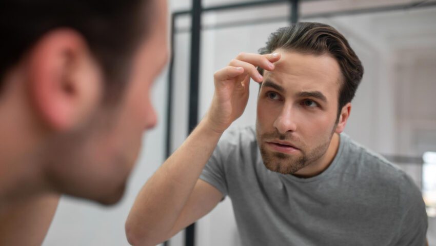 Your Hairline Is Either Helping You or Betraying You